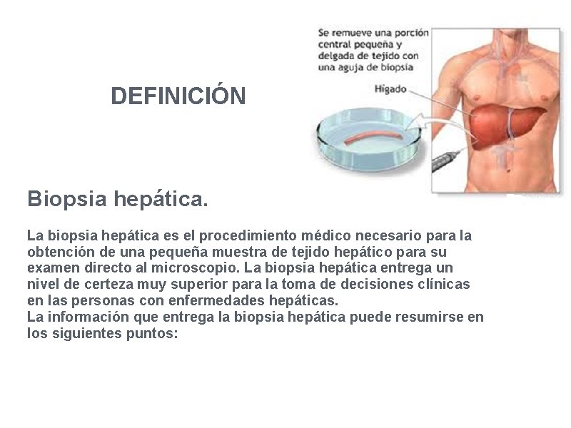 DEFINICIÓN Biopsia hepática. La biopsia hepática es el procedimiento médico necesario para la obtención