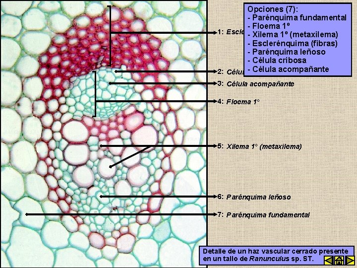 Opciones (7): - Parénquima fundamental - Floema 1º 1: Esclerénquima - Xilema(fibras) 1º (metaxilema)