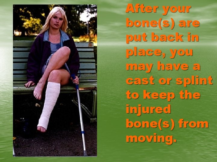 After your bone(s) are put back in place, you may have a cast or