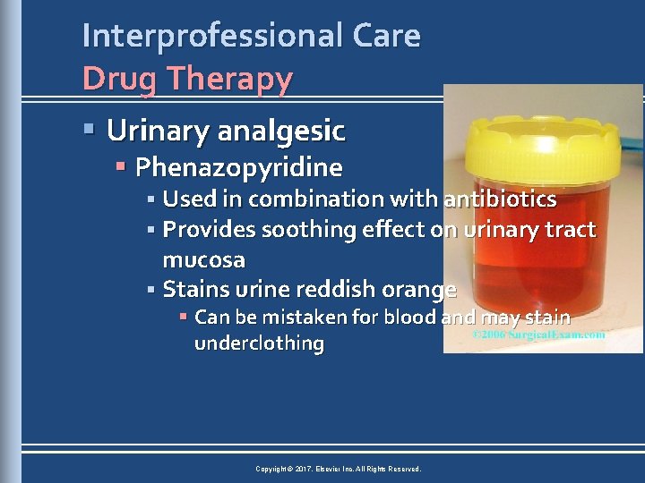 Interprofessional Care Drug Therapy § Urinary analgesic § Phenazopyridine § Used in combination with