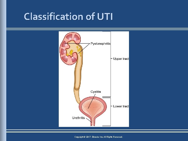 Classification of UTI Copyright © 2017, Elsevier Inc. All Rights Reserved. 