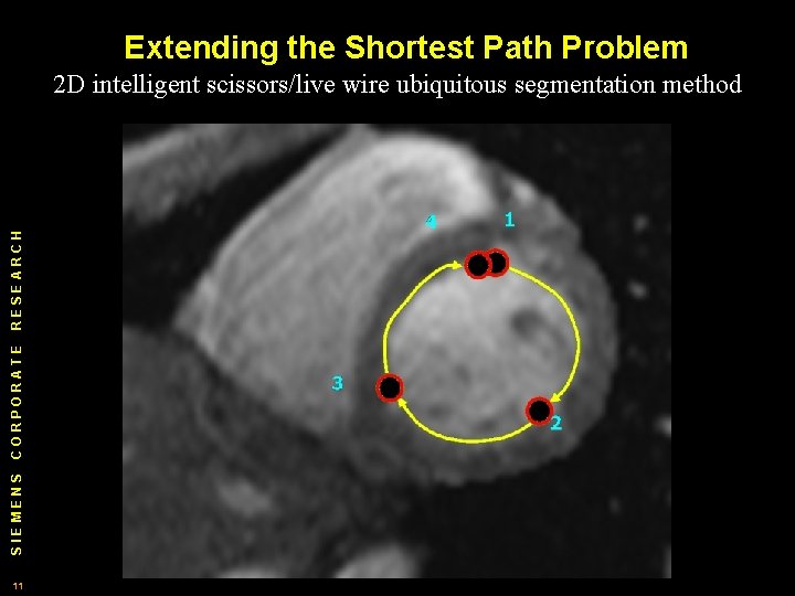 Extending the Shortest Path Problem SIEMENS CORPORATE RESEARCH 2 D intelligent scissors/live wire ubiquitous Extending the Shortest Path Problem SIEMENS CORPORATE RESEARCH 2 D intelligent scissors/live wire ubiquitous