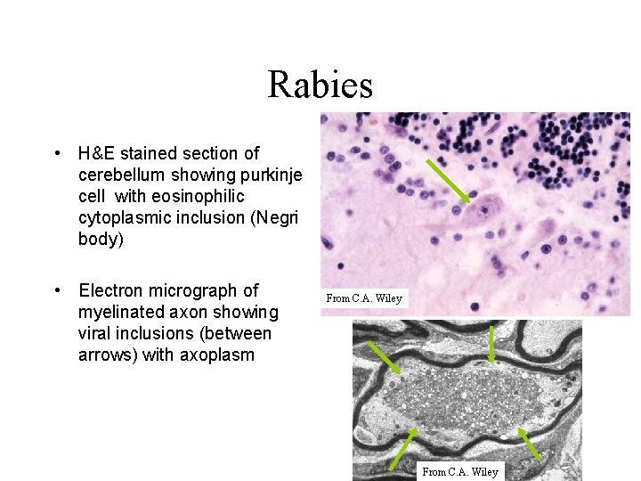 Neurovirology Acute viral infections Rabies Enteroviridae Mumps ...