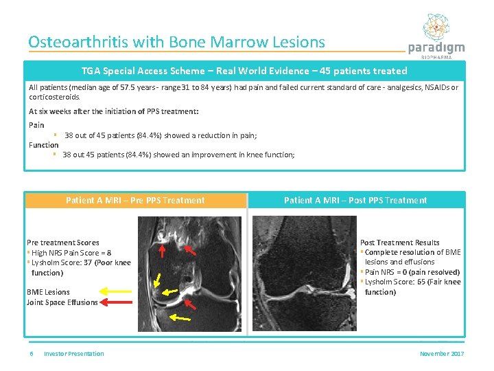 Osteoarthritis with Bone Marrow Lesions TGA Special Access Scheme – Real World Evidence –