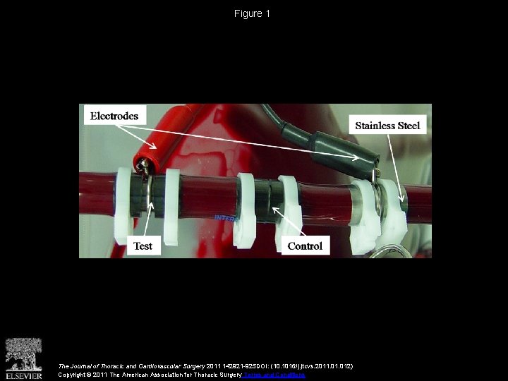 Figure 1 The Journal of Thoracic and Cardiovascular Surgery 2011 142921 -925 DOI: (10.