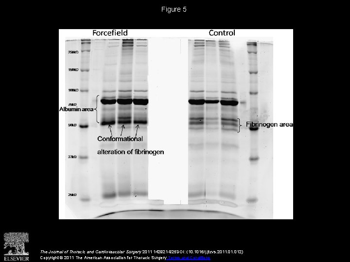 Figure 5 The Journal of Thoracic and Cardiovascular Surgery 2011 142921 -925 DOI: (10.