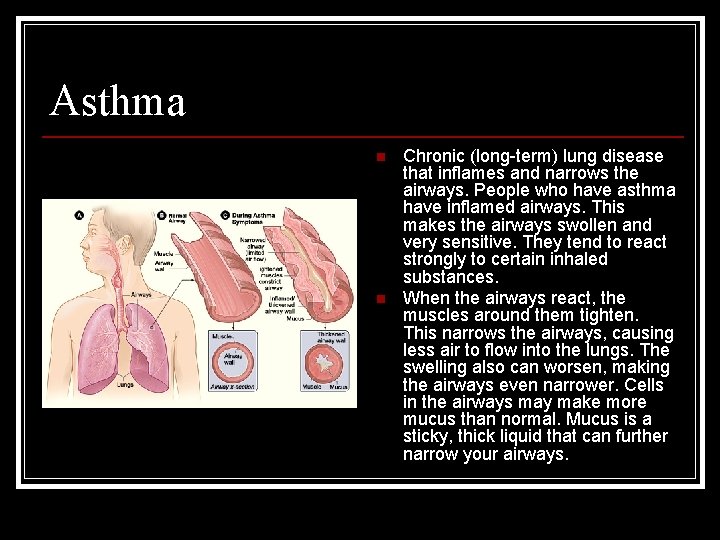 Asthma n n Chronic (long-term) lung disease that inflames and narrows the airways. People