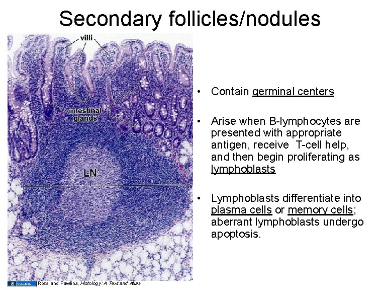Secondary follicles/nodules • Contain germinal centers • Arise when B-lymphocytes are presented with appropriate