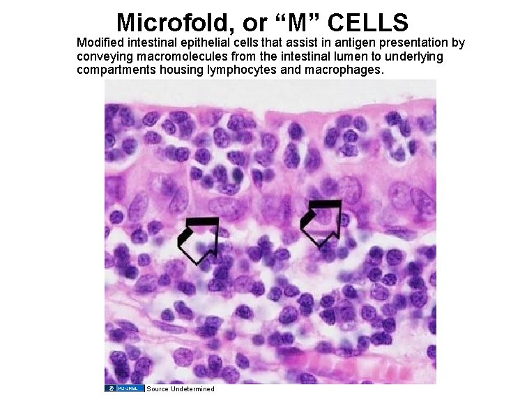 Microfold, or “M” CELLS Modified intestinal epithelial cells that assist in antigen presentation by