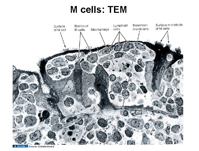 M cells: TEM Source Undetermined 