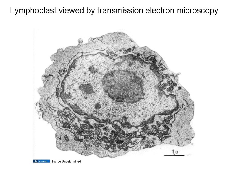 Lymphoblast viewed by transmission electron microscopy Source Undetermined 