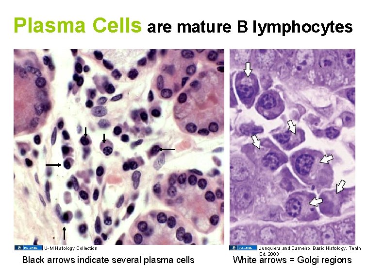 Plasma Cells are mature B lymphocytes U-M Histology Collection Black arrows indicate several plasma