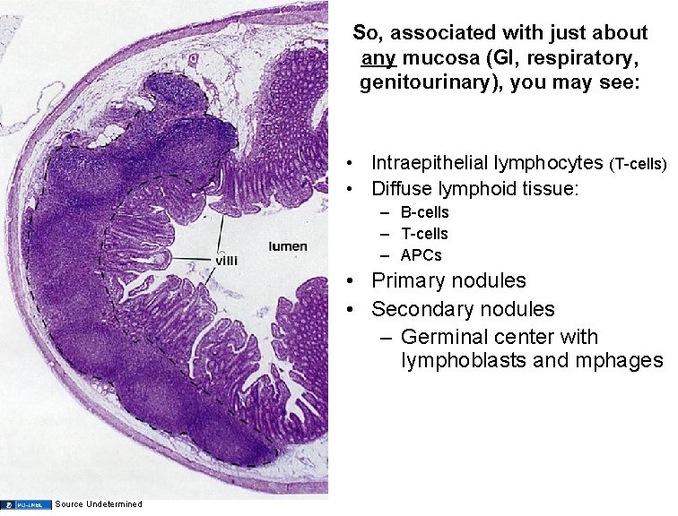 So, associated with just about any mucosa (GI, respiratory, genitourinary), you may see: •