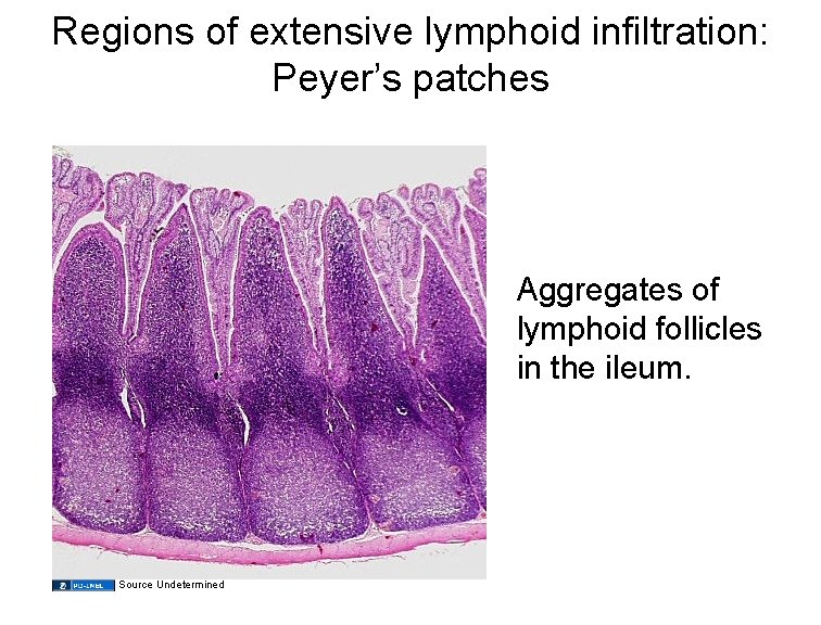 Regions of extensive lymphoid infiltration: Peyer’s patches Aggregates of lymphoid follicles in the ileum.