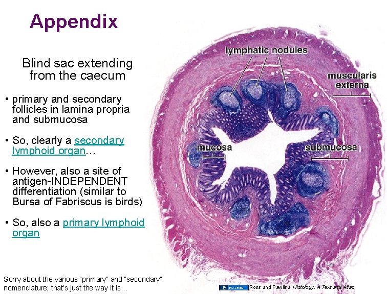 Appendix Blind sac extending from the caecum • primary and secondary follicles in lamina