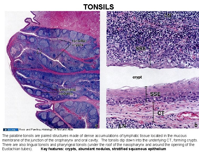 TONSILS Ross and Pawlina, Histology: A Text and Atlas The palatine tonsils are paired