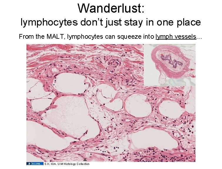 Wanderlust: lymphocytes don’t just stay in one place From the MALT, lymphocytes can squeeze