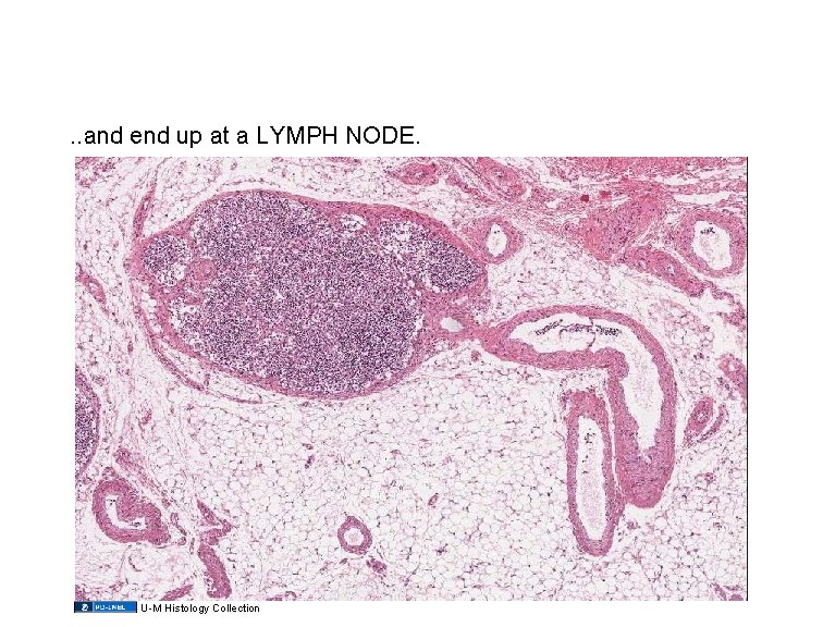 . . and end up at a LYMPH NODE. U-M Histology Collection 