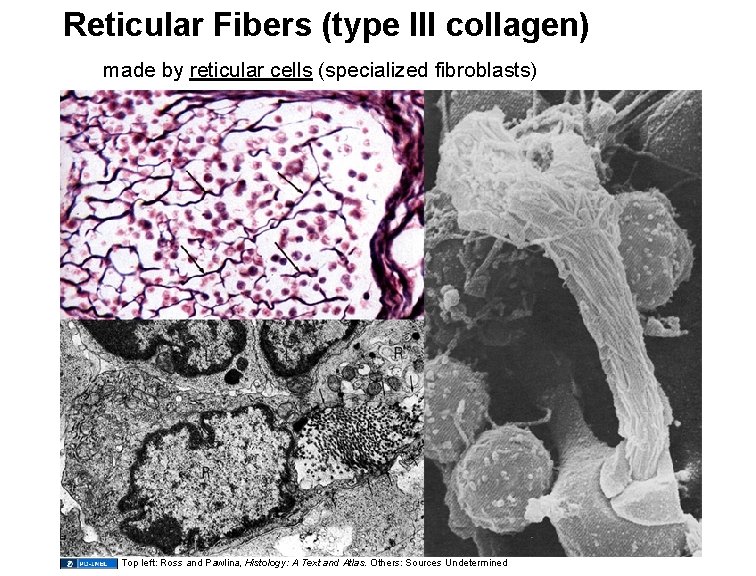 Reticular Fibers (type III collagen) made by reticular cells (specialized fibroblasts) Top left: Ross