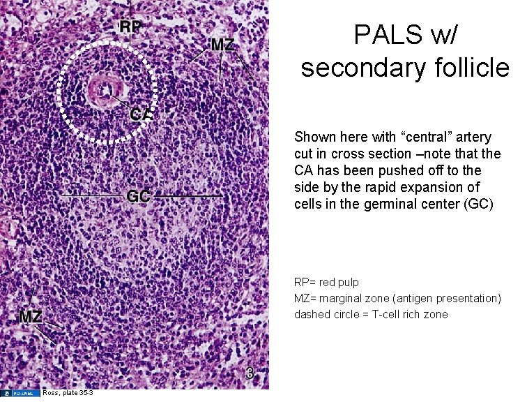 PALS w/ secondary follicle Shown here with “central” artery cut in cross section –note