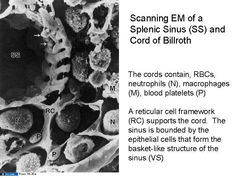 Scanning EM of a Splenic Sinus (SS) and Cord of Billroth The cords contain,