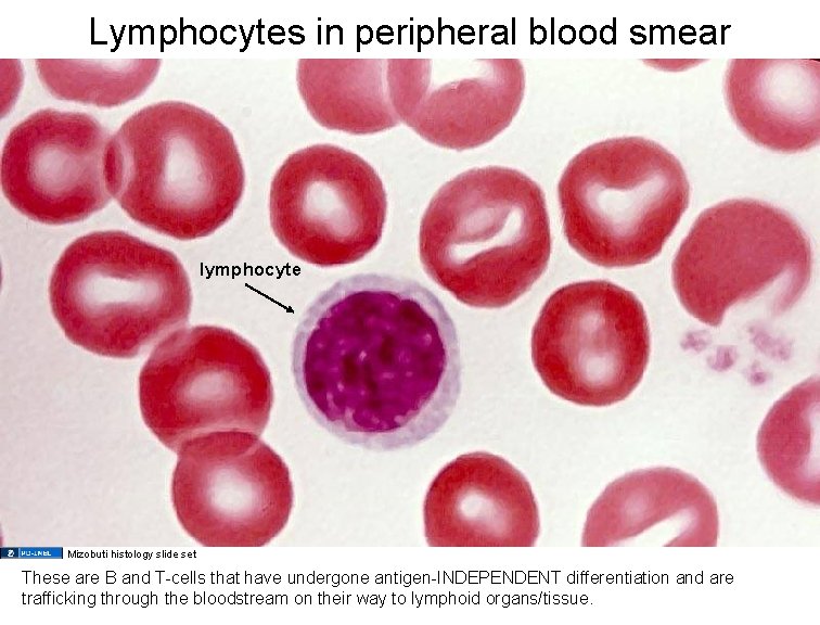 Lymphocytes in peripheral blood smear lymphocyte Mizobuti histology slide set These are B and