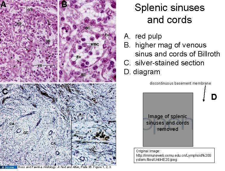 A B Splenic sinuses and cords A. red pulp B. higher mag of venous