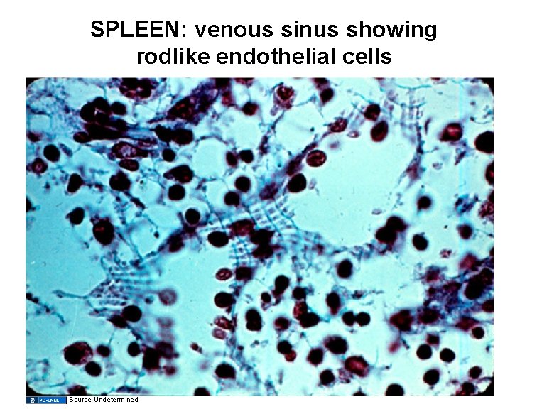 SPLEEN: venous sinus showing rodlike endothelial cells Source Undetermined 