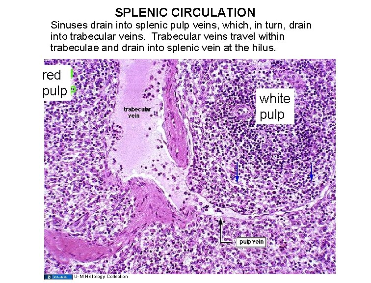 SPLENIC CIRCULATION Sinuses drain into splenic pulp veins, which, in turn, drain into trabecular