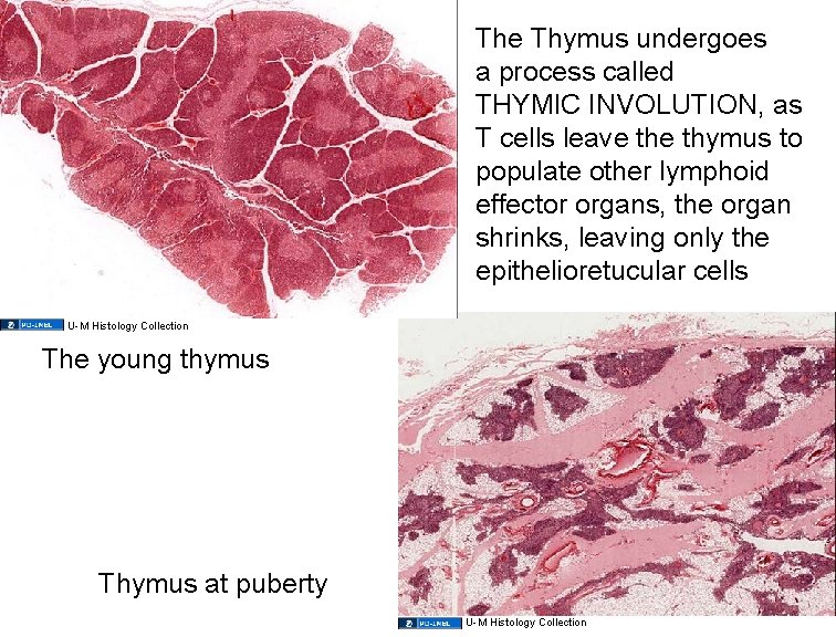 The Thymus undergoes a process called THYMIC INVOLUTION, as T cells leave thymus to