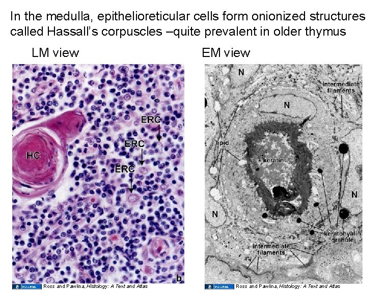 In the medulla, epithelioreticular cells form onionized structures called Hassall’s corpuscles –quite prevalent in