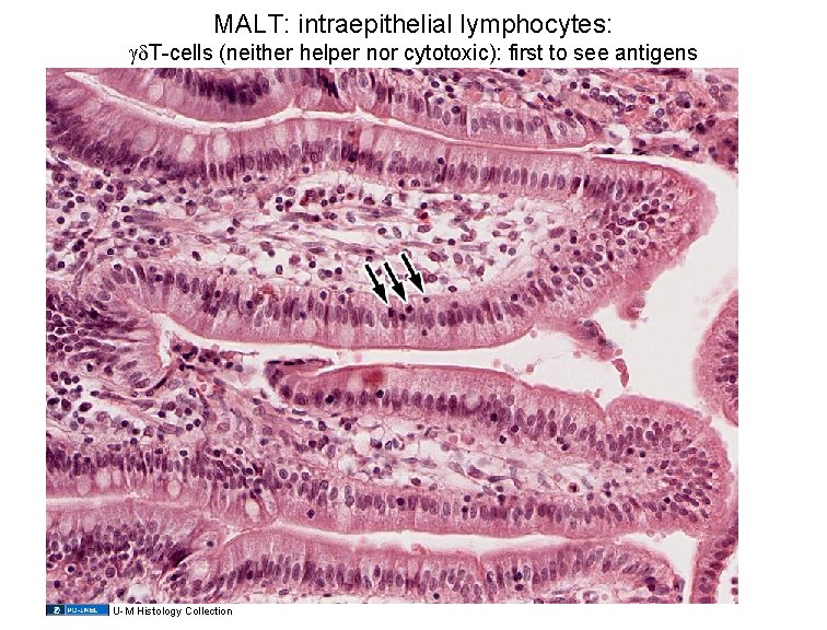 MALT: intraepithelial lymphocytes: T-cells (neither helper nor cytotoxic): first to see antigens U-M Histology