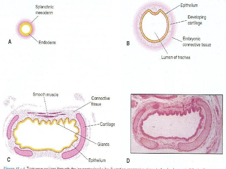 DEVELOPMENT OF LARYNX TRACHEA AND BRONCHI Dr Mujahid