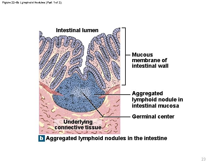Figure 22– 5 b Lymphoid Nodules (Part 1 of 2). Intestinal lumen Mucous membrane