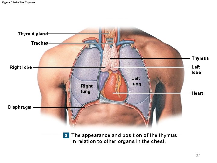 Figure 22– 7 a The Thymus. Thyroid gland Trachea Thymus Left lobe Right lung