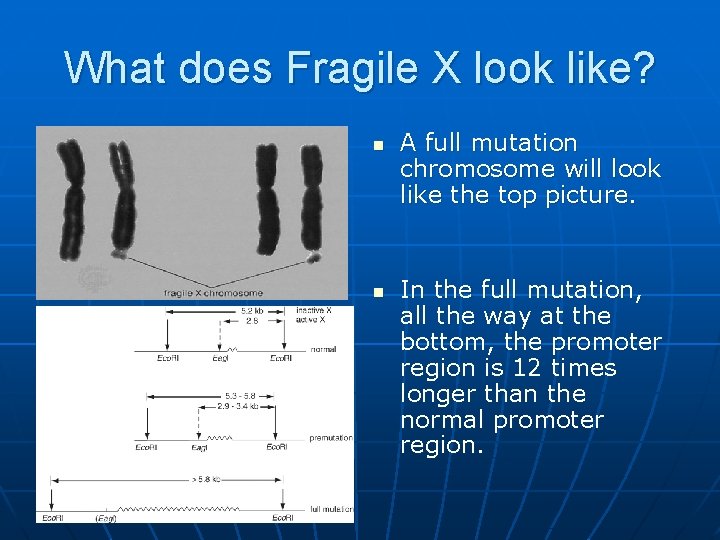 What does Fragile X look like? n n A full mutation chromosome will look