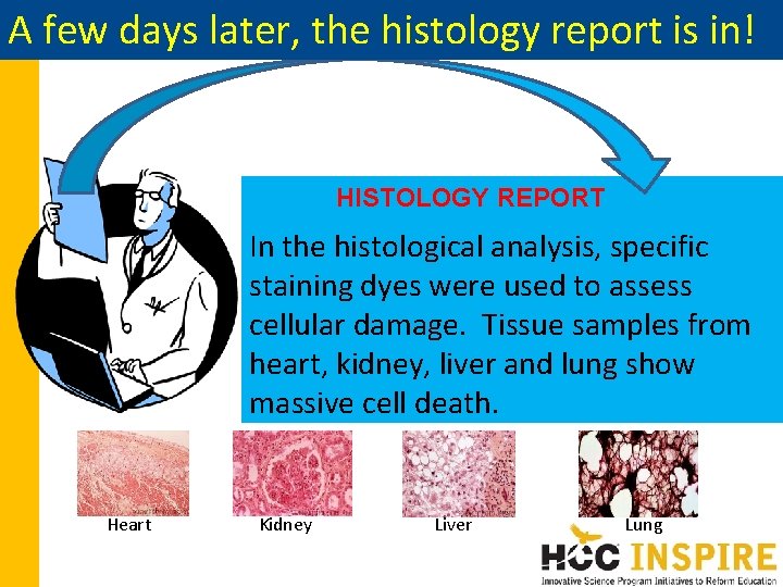 A few days later, the histology report is in! HISTOLOGY REPORT In the histological A few days later, the histology report is in! HISTOLOGY REPORT In the histological