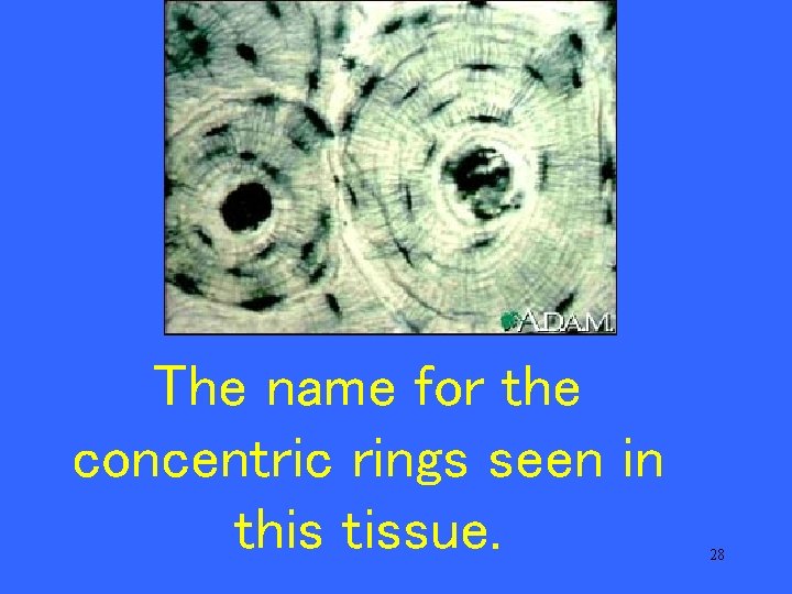 The name for the concentric rings seen in this tissue. 28 