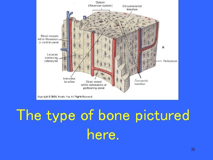 The type of bone pictured here. 30 