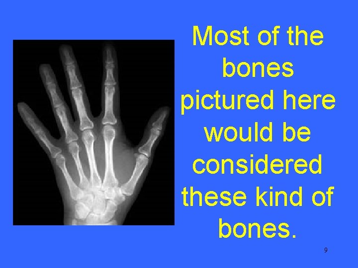 Most of the bones pictured here would be considered these kind of bones. 9