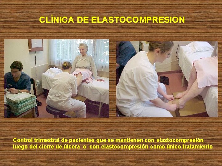 CLÍNICA DE ELASTOCOMPRESION Control trimestral de pacientes que se mantienen con elastocompresión luego del