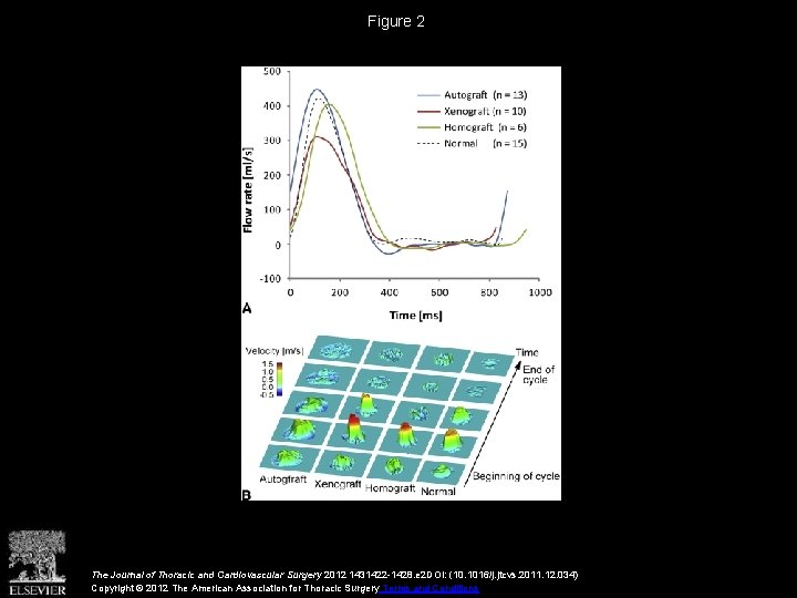 Figure 2 The Journal of Thoracic and Cardiovascular Surgery 2012 1431422 -1428. e 2