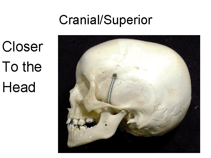 Cranial/Superior Closer To the Head 