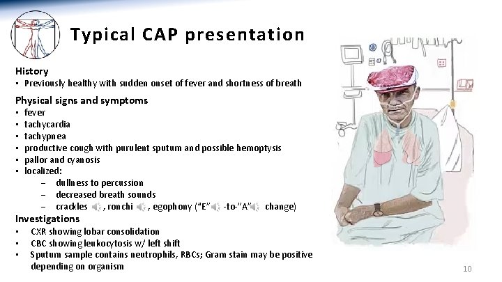 Typical CAP presentation History • Previously healthy with sudden onset of fever and shortness