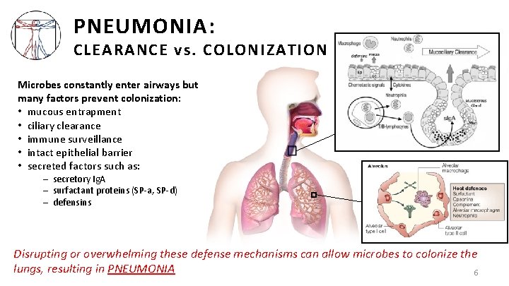 PNEUMONIA: CLEARANCE vs. COLONIZATION Microbes constantly enter airways but many factors prevent colonization: •