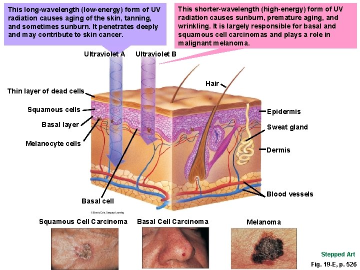 This long-wavelength (low-energy) form of UV radiation causes aging of the skin, tanning, and