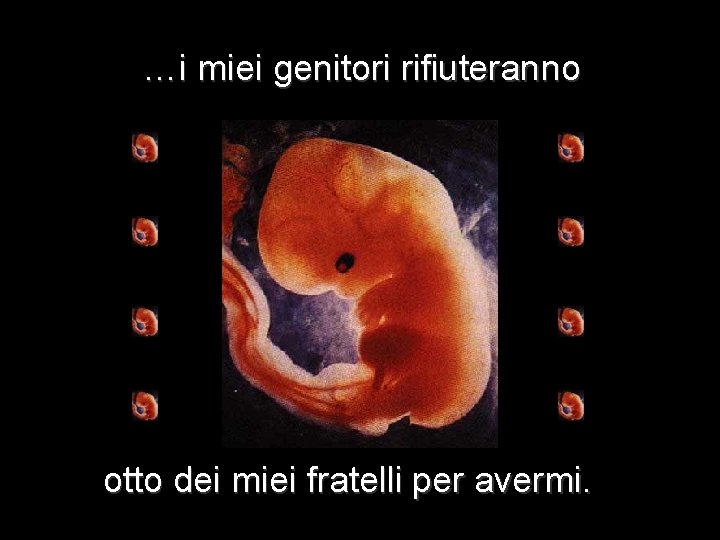 …i miei genitori rifiuteranno otto dei miei fratelli per avermi. 