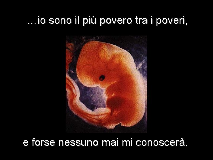 …io sono il più povero tra i poveri, e forse nessuno mai mi conoscerà.