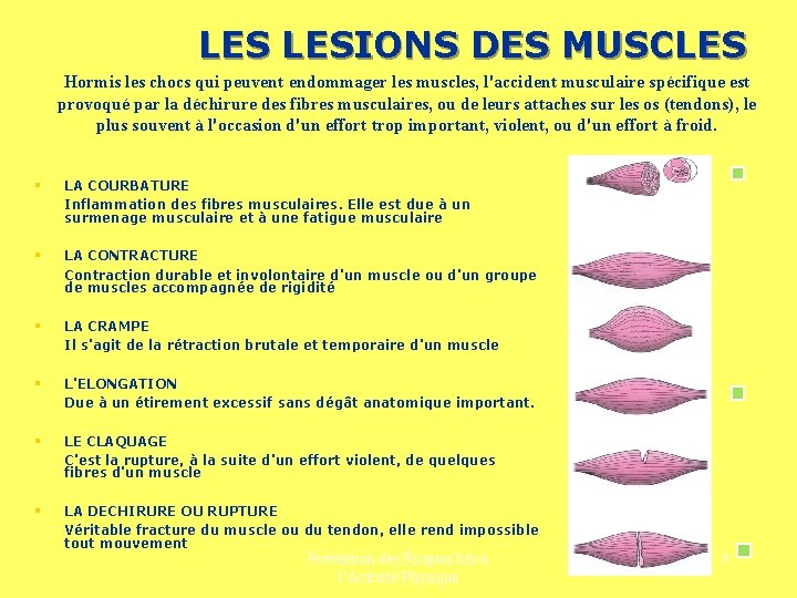 LES LESIONS DES MUSCLES Hormis les chocs qui peuvent endommager les muscles, l'accident musculaire