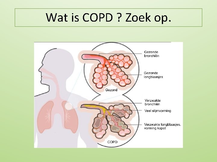 Wat is COPD ? Zoek op. 